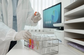 生物负载检测标准有哪些 微生物负载检验方法